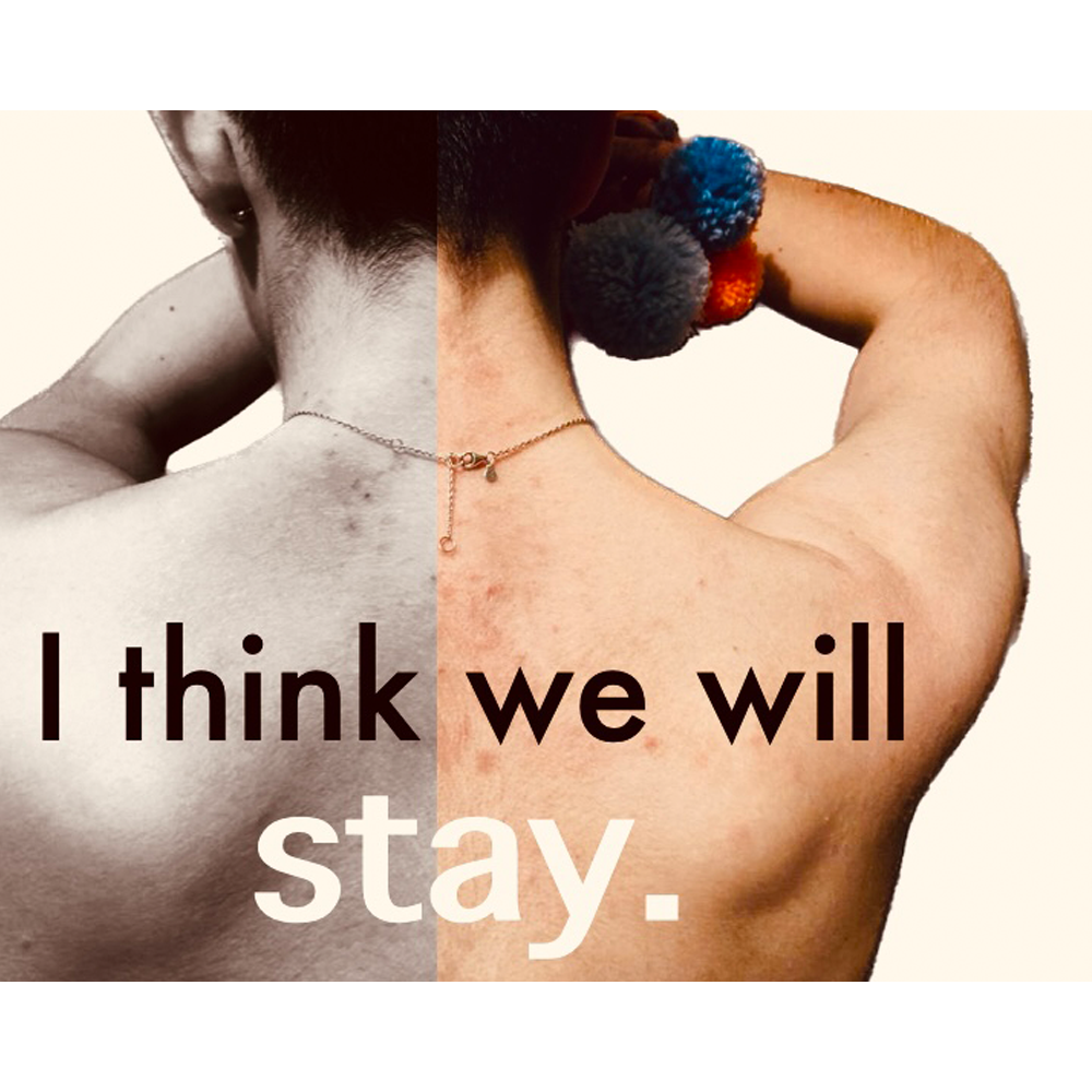 'I think we will stay'